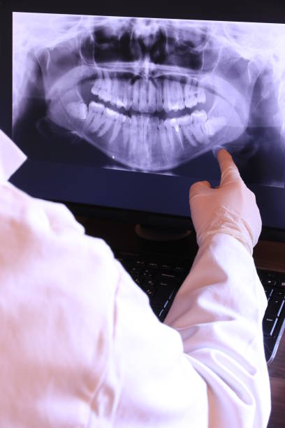 Best Emergency Root Canal Treatment in Varnell, GA
